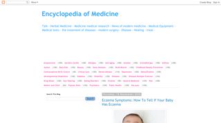 لقطة شاشة لموقع Encyclopedia of Medicine
بتاريخ 21/09/2019
بواسطة دليل مواقع الاقرب